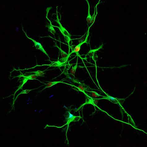 Neurones cérébraux obtenus au moyen de cellules souches embryonnaires. Crédit ULB.