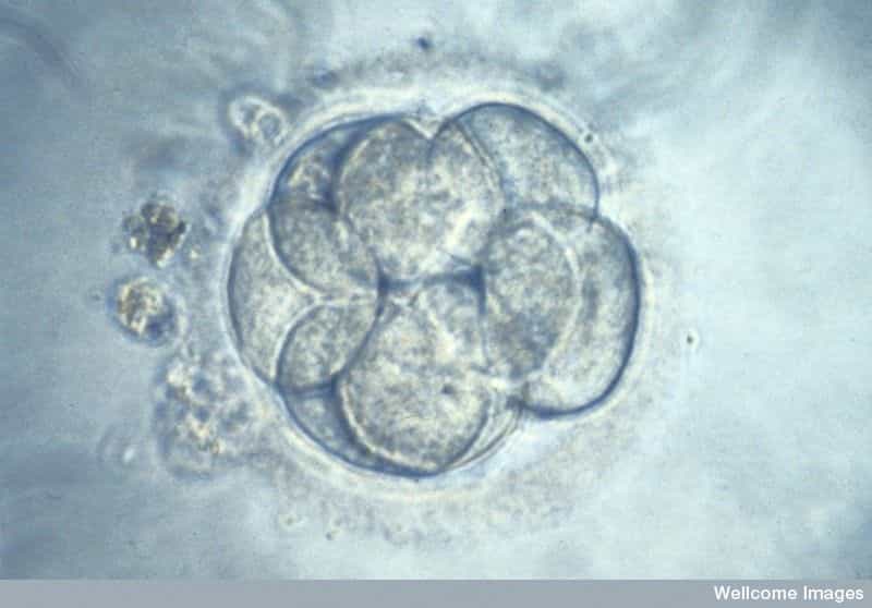 La modification génétique de l’embryon humain se retrouve au cœur des débats depuis l'utilisation de la technique CRISPR/Cas9. © K. Hardy, Welcome Images, CC by-nc-nd 2.0