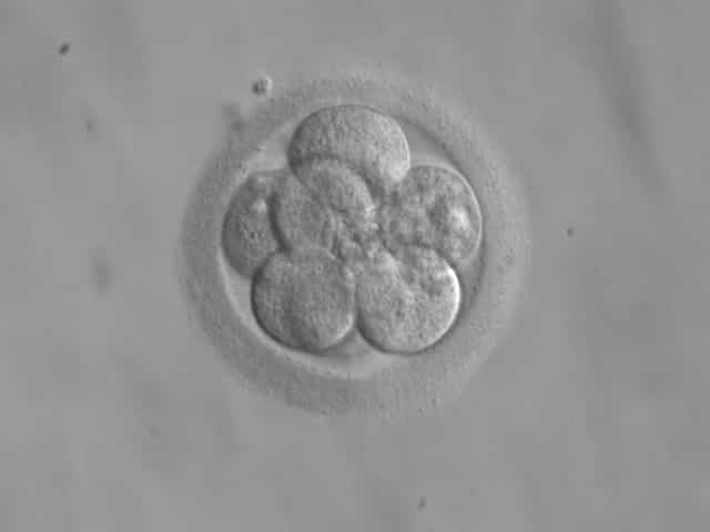 Les embryons humains contiennent des cellules souches pluripotentes voire totipotentes, capables de se différencier en n'importe quel tissu. Cette propriété intéresse des scientifiques, qui y voient l'occasion de soigner des maladies aujourd'hui incurables. Mais une telle récolte, réalisée dans les toutes premières phases de développement, s'accompagne de la destruction de l'embryon, ce qui soulève des questions éthiques. © Ekem, Wikipédia, DP