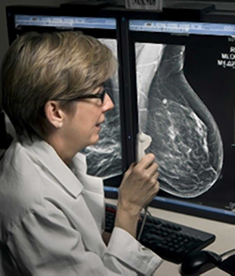 Après avoir subi une mastectomie, 30 % des femmes ont recours à une reconstruction mammaire. © DR