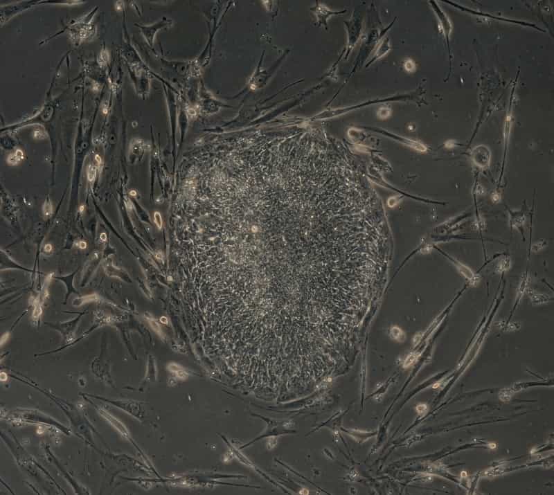 Ces cellules de peau humaine se sont transformées en cellules totipotentes après l’introduction de quatre gènes. © Junying Yu