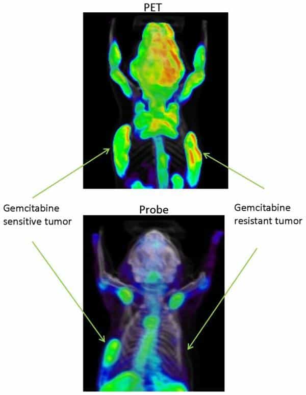 En haut, une image prise avec un PET scan d'une souris traitée à la gemcitabine et en bas la même souris avec la molécule ressemblant à la gemcitabine mais inactive. On voit à gauche l'effet sur une tumeur réceptive à la gemcitabine et à droite sur la seconde tumeur qui n'y est pas sensible. Clairement, le dépistage du manque d'effet du traitement s'y révèle dans ce dernier cas par le manque de concentration de produit dans la tumeur en bas à droite, qui n'émet que fort peu de positrons. Crédit : University of California - Los Angeles