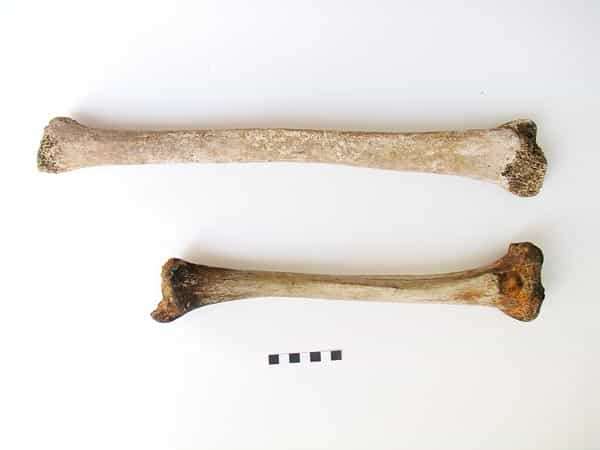 Le tibia du Romain souffrant de gigantisme (en haut) a été comparé à un os prélevé chez un individu sain ayant vécu à la même époque (en bas). La différence est notable. © Simona Minozzi, Endocrine Society