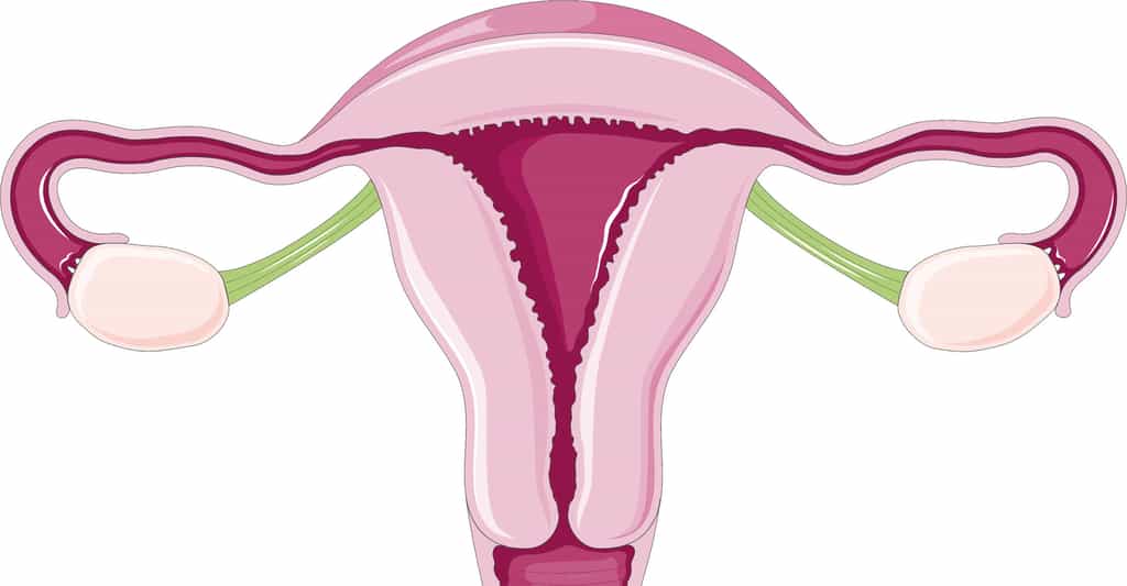 La grossesse extra-utérine : une anomalie de siège