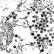Coupe ultra fine de cellules infectées par le virus de l'encéphalite équine orientale. Grossissement x70000. Les virions sont observables sous forme de petites sphères noires.Crédit: F. A. Murphy, School of Veterinary
