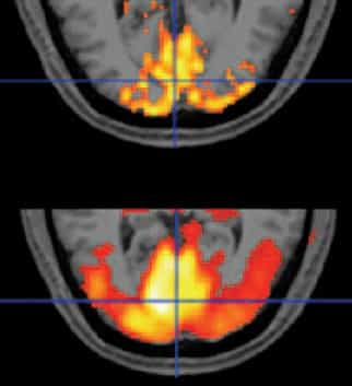 Activation du cortex visuel vu par l'IRMd (haut) et l'IRMf (bas) :la réponse de l'IRMd est plus précoce et moins floue.