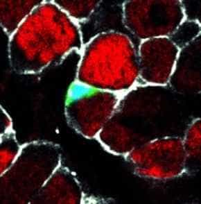 Coupe transversale de muscle d'embryon de poulet à 18 jours de développement. Les membranes cellulaires sont visibles en blanc.(crédit : &copy; Photothèque du CNRS)