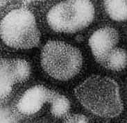 Le virus influenza de type A responsable de la grippe