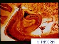 INSERM 88.Hippocampe de rat irradié. Coloration timm.