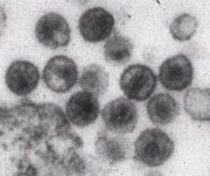 Image en microscopie électronique du virus VIH.