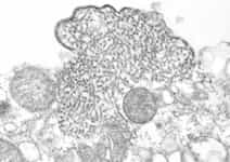 Nipah virus electron micrograph Image courtesy of C.S. Goldsmith and P.E. Rollin (CDC), and K.B. Chua (Malaysia).