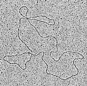 Plasmide vu au microscope électronique.