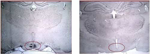 Ces microphotographies montrent une coupe de l'hypothalamus de rats soumis à un régime riche en protéines (à gauche) et de rats témoins (à droite). Les taches sombres révèlent la présence de facteurs impliqués dans la mise en place de la sensation de sati