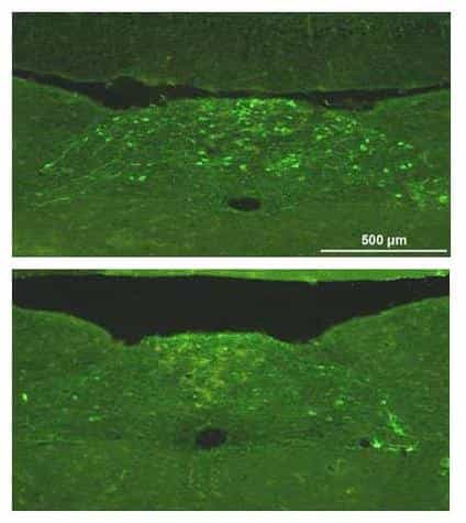 Tissus neuronaux d'une souris normale (en haut) et d'une souris mutante (en bas). Les points vert clair représentent les marqueurs biologiques de la noradrénaline, substance régulatrice du rythme de la respiration. Ils sont moins nombreux à droite, ce qui