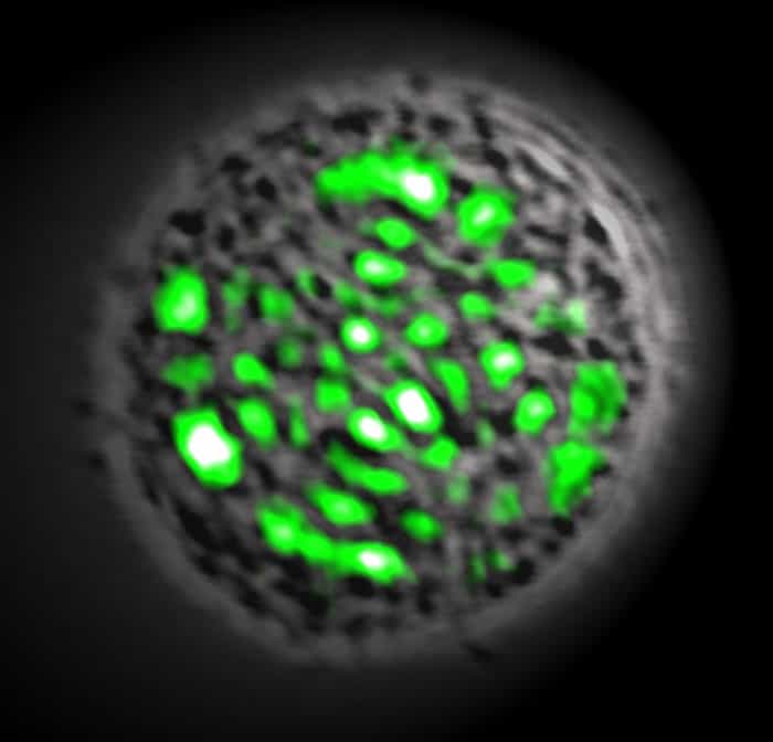 Une des cellules de rein observées au microscope en train de rayonner par effet laser. © Malte Gather