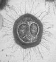 Le Mimivirus (ici sur la photo) est phylogénétiquement le plus proche virus du CroV. © D. Raoult, N. Aldrovandi, CNRS photothèque