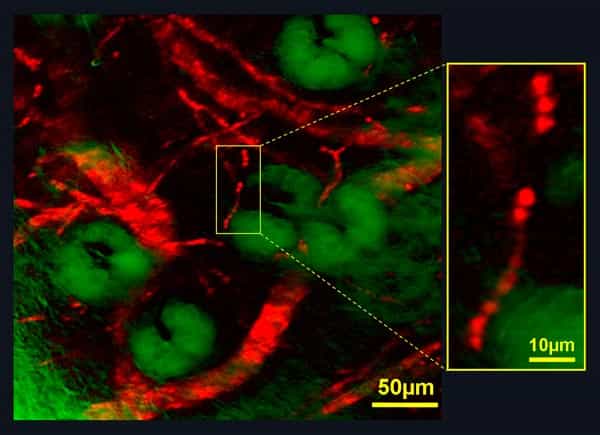 Obtenue par microscopie par émission stimulée, cette image montre les vaisseaux sanguins (en rouge) parcourant une oreille de souris. Les grosses taches vertes sont des glandes sébacées. Les globules rouges portant les molécules d'hémoglobine se comportant comme des minis lasers sont bien visibles à droite. Crédit : W Min/S Lu/Harvard University