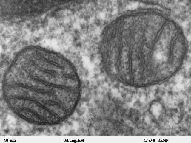 Les mitochondries ne nous ont pas encore tout dit sur leurs origines. Victimes de phagocytose ou coupables de parasitisme ? © Louisa Howard, Wikipédia, DP