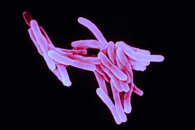 Il faut environ un mois pour détecter les antibiotiques auxquels résiste une souche de&nbsp;Mycobacterium tuberculosis, l'agent de la tuberculose. Le patient n'a pas ce temps devant lui pour être traité. C'est pourquoi une lamelle fine vibrant tel un diapason&nbsp;quand les bactéries sont vivantes peut accélérer très fortement le diagnostic.&nbsp;© Sanofi Pasteur, Flickr, cc by nc nd 2.0