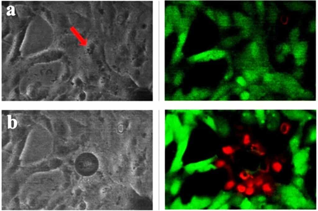 Les cellules cancéreuses avant (a) et après (b) la destruction photothermique utilisant un faisceau laser continu dans le proche infrarouge. Les cellules vivantes sont colorées en vert et les cellules mortes sont colorées en rouge. © University of Texas at Arlington