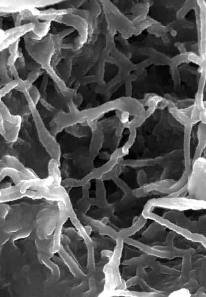 Le polymère mis au point par l'équipe, vu au microscope électronique à balayage. © Case Western Reserve University