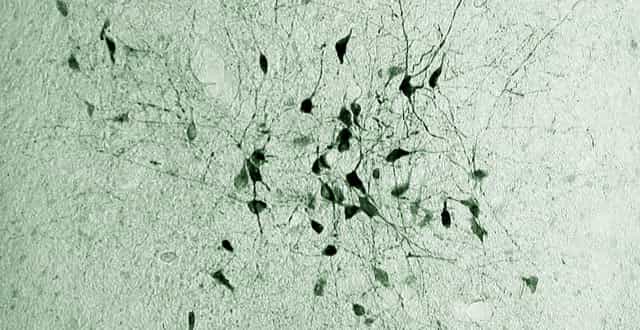 Si ces dernières années, on a découvert des neurones sous la dépendance du système nerveux, ils n'avaient jamais été retrouvés dans l'hypothalamus, structure impliquée à de nombreux niveaux de l'organisme, comme la thermorégulation. © Jens Mittag et al.