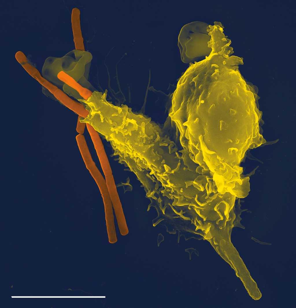 Le nombre de neutrophiles (ici en jaune), cellules immunitaires chargées de la phagocytose, diminue avec le temps, aussi bien chez l'homme que chez la femme. © Volker Brinkmann, Plos Pathogens, cc by 2.5