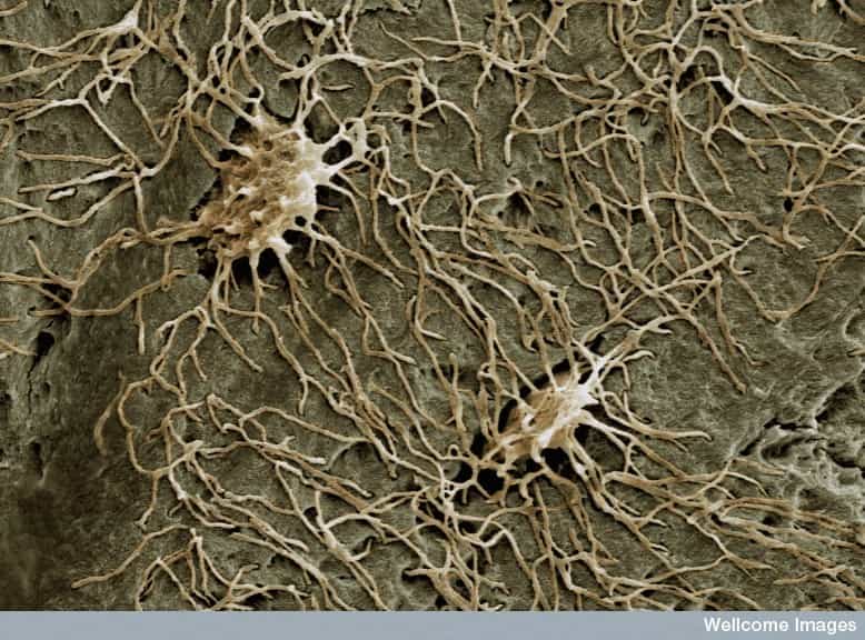 Les ostéocytes, issus des ostéoblastes, sont des cellules qui participent au maintien de la structure osseuse. Ils communiquent entre eux via de longues jonctions cytoplasmiques. Leur rôle est fondamental après une fracture. © Kevin McKenzie, Wellcome Images, Flickr, cc by nc nd 2.0