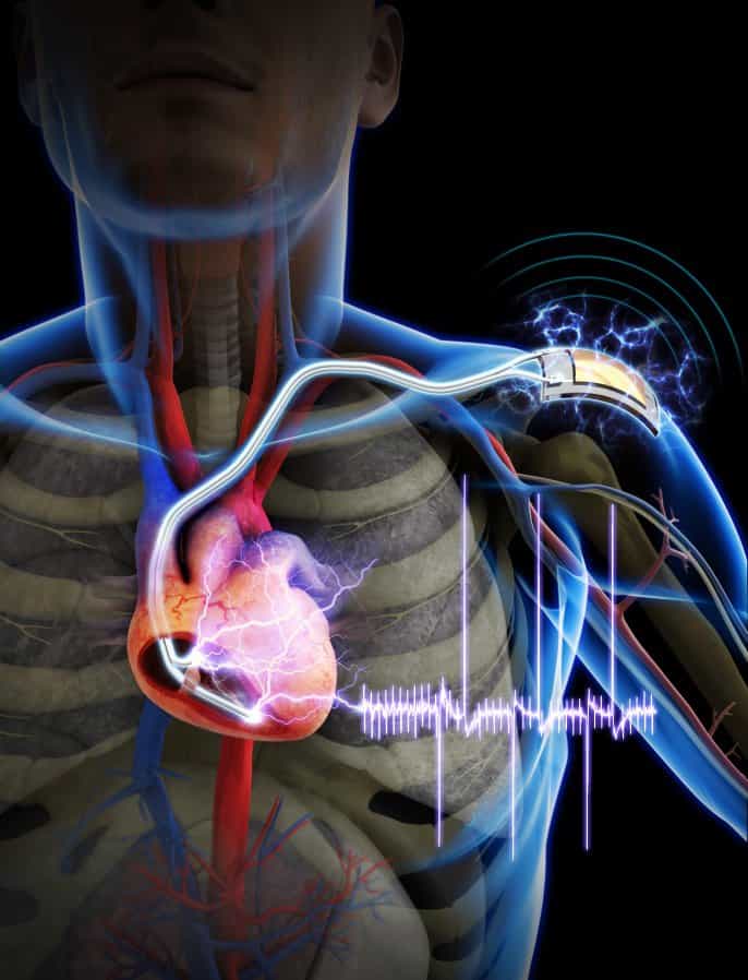 Grâce à un nanogénérateur flexible, des chercheurs de l'Institut supérieur coréen des sciences et technologies sont parvenus à alimenter un stimulateur cardiaque implanté sur un rat. Le système produit l’énergie à partir des mouvements des muscles. Il ne pourrait pas remplacer complètement la batterie d’un pacemaker mais au moins prolonger sa durée de vie qui est actuellement d'environ sept ans. © KAIST