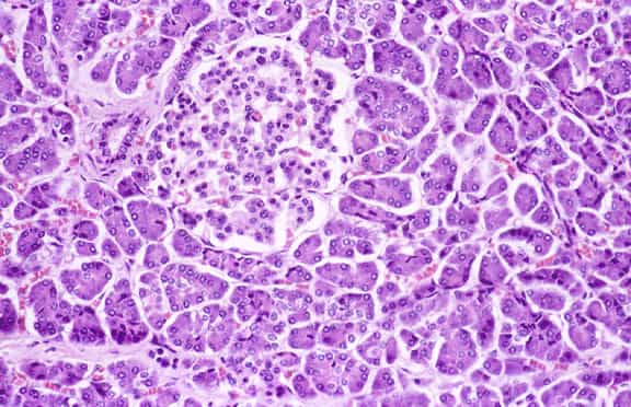 Coupe de pancréas. La zone à peu près ronde est un îlot de Langerhans, dont les cellules produisent l'insuline et le glucagon, deux hormones impliquées dans la régulation de la glycémie. © Department of Pathology / Duke University Medical Center