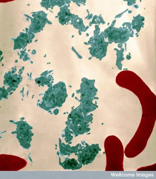 Les plaquettes, ici en vert, sont des éléments du sang, au même titre que les globules rouges (en rouge à l'image). Elles sont indispensables pour une bonne coagulation sanguine. © University of Edinburgh, Wellcome Images, cc by nc nd 2.0