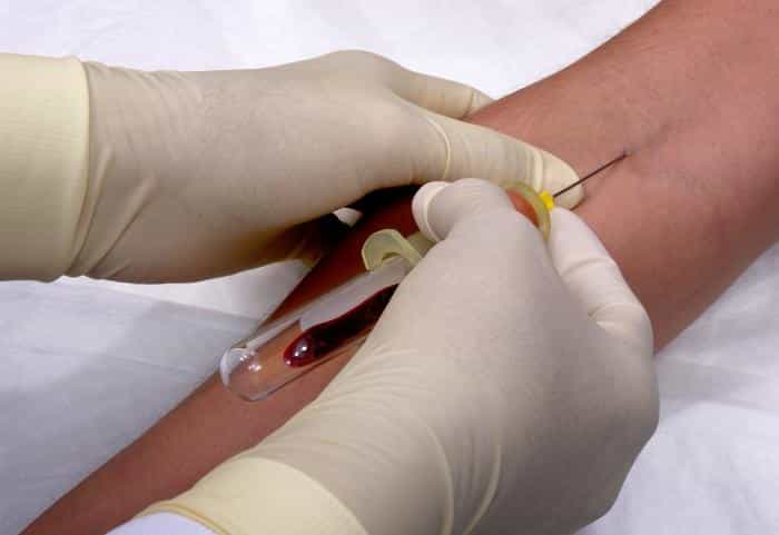 Une prise de sang est nécessaire pour détecter l'état sérologique du patient. Si dans son sang circulent les anticorps recherchés, alors le patient est séropositif. Dans le cas contraire, on le dit séronégatif.&nbsp;© James Gathany, CDC