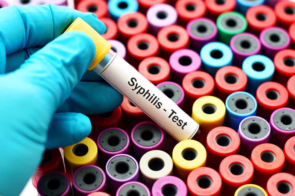 La syphilis est une infection contractée lors de rapports non protégés, donc sexuellement transmissible (IST). Non traitée, elle entraîne de nombreuses complications irréversibles. © jarun011, Fotolia