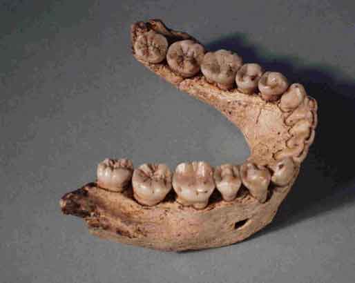 La forme générale de la mandibule D-211 trouvée à Dmanisi, en Géorgie, diffère de toutes celles connues pour Homo erectus. Et pour cause : elle n'appartiendrait pas à cette espèce, contrairement à ce qu’on a cru jusqu'en 2007. © David Lordkipanidze