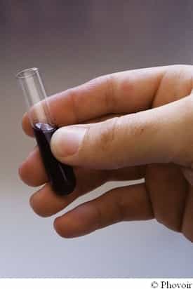 Le test sanguin est dix fois moins coûteux que le scanner. © Phovoir