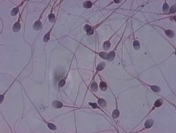 Spermatozoïdes colorés au papanicolaou (colorant cytologique pentachrome). © CPMA