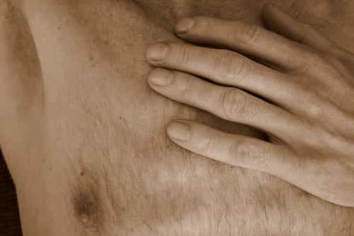 Les hommes aussi peuvent être atteints d'un cancer du sein. © just.Luc / Licence Creative Commons
