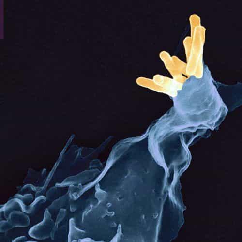 La bactérie Mycobacterium tuberculosis, ou bacille de Koch, peut être phagocytée par les cellules immunitaires (ici en image). Ce redoutable agent infectieux cause la tuberculose mais peut aussi vivre caché. Il suivrait les humains depuis très longtemps selon une étude génétique. © AJC1, Flickr, CC by-nc 2.0
