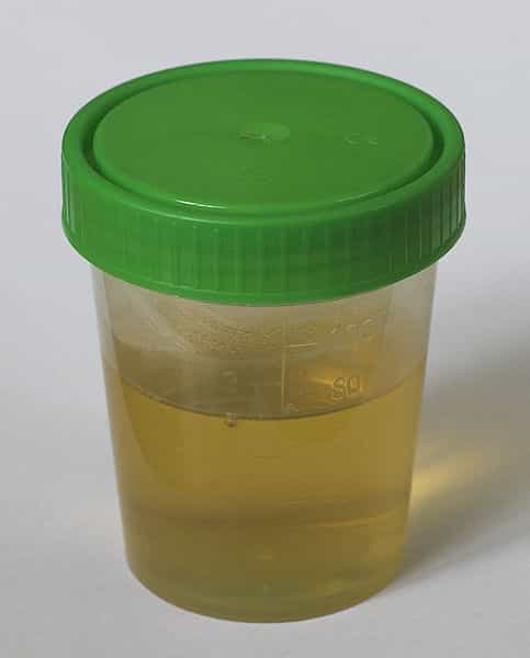 Chaque jour, en moyenne, un individu sans pathologie sécrète environ 1L d'urine. De quoi créer pas mal de cellules du cerveau !&nbsp;© Polarlys, Wikipédia, cc by sa 3.0