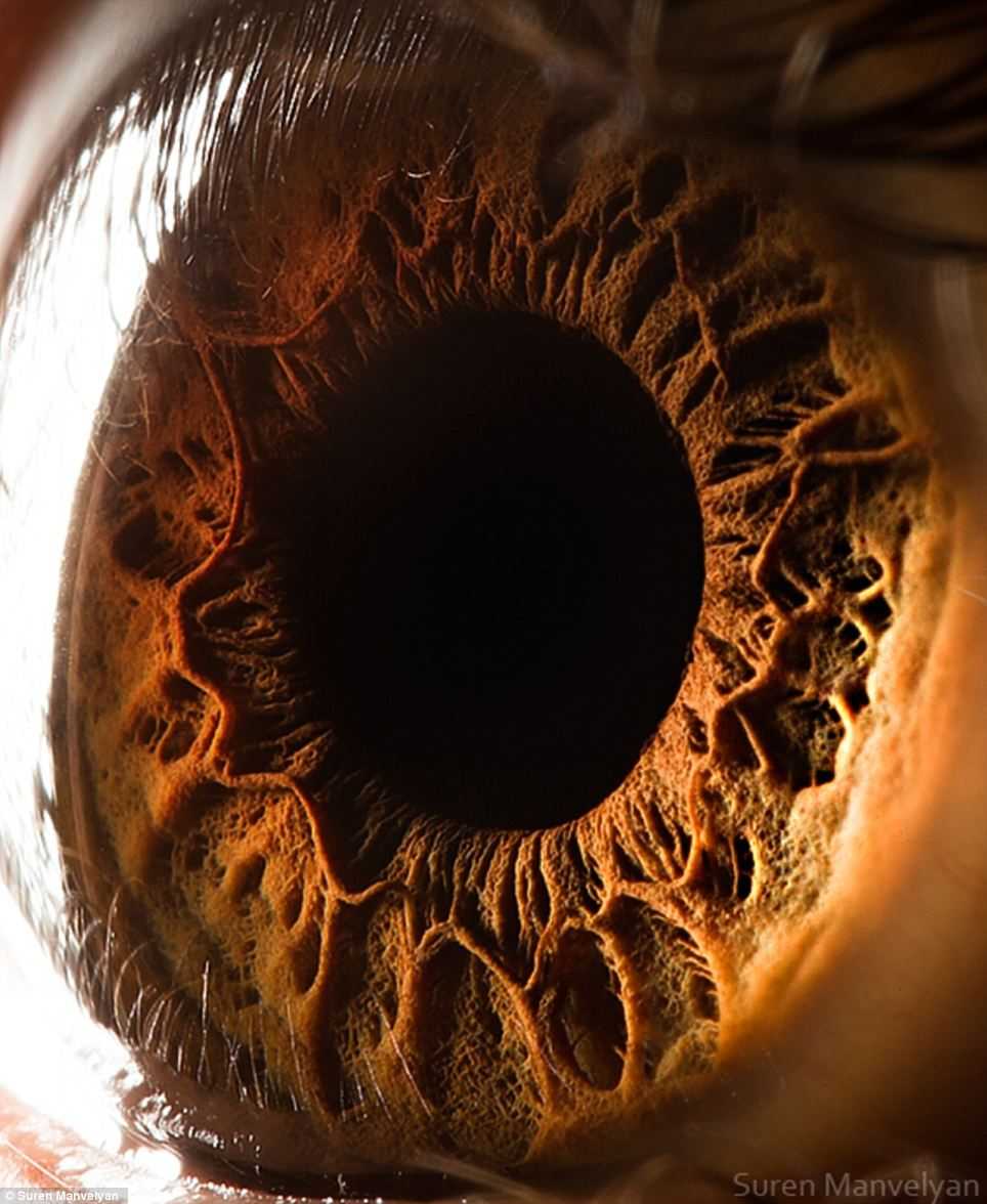 L'iris de cet œil ressemble à un paysage volcanique. Les structures à l'apparence rocheuses sont les muscles qui permettent la contraction et la dilatation de la pupille. © Suren Manvelyan