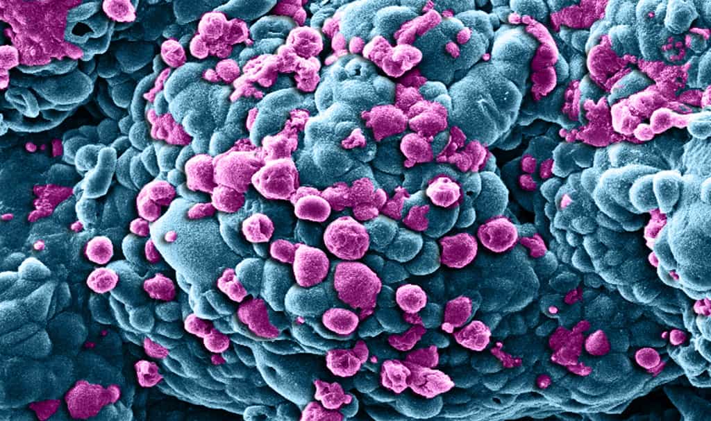 Cellules de cancer du sein traitées par une méthode de nanomédecine apportant un médicament anti-cancer. Les zones colorées en violet correspondent à des cellules en train de mourir par apoptose, contrairement aux bleues. © Khuloud T Al-Jamal et Izzat Suffian, Wellcome Image