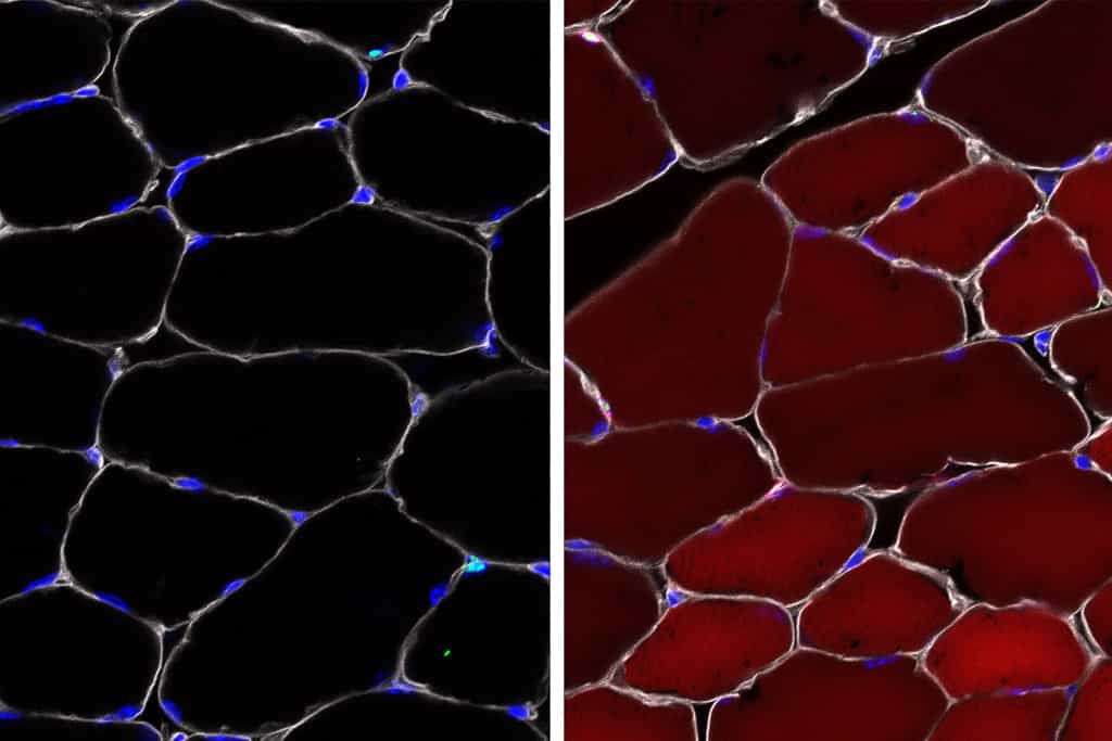 Images avant/après montrant les cellules souches devenir rouges fluorescentes une fois modifiées in vivo, une prouesse quand on sait que ces cellules sont d'ordinaire corrigées in vitro. © Bryan Peacker/Wagers laboratory at Harvard University