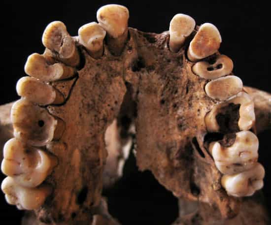 Les dents des chasseurs-cueilleurs ayant vécu dans l'actuel Maroc étaient bien érodées par la consommation de fruits à coque. © Avec l'aimable autorisation d'Isabelle De Groote
