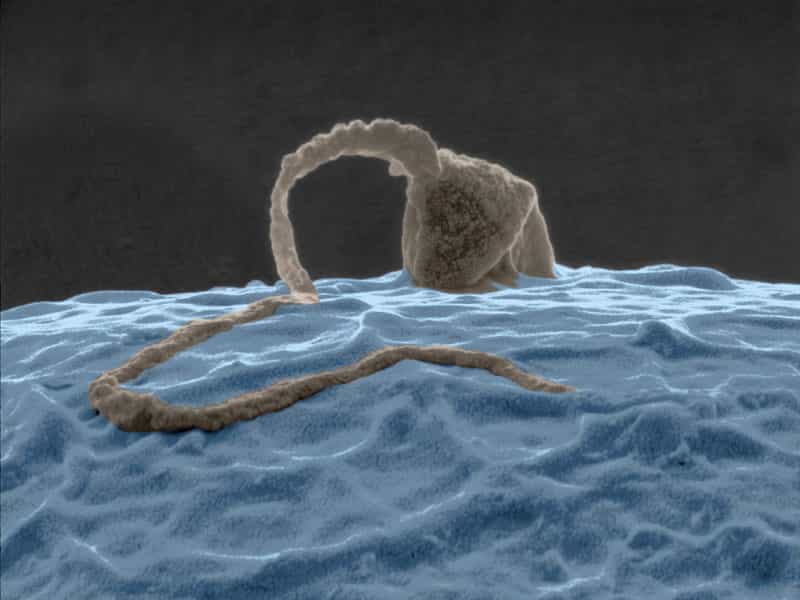 Le spermatozoïde et l'ovule en microscopie électronique