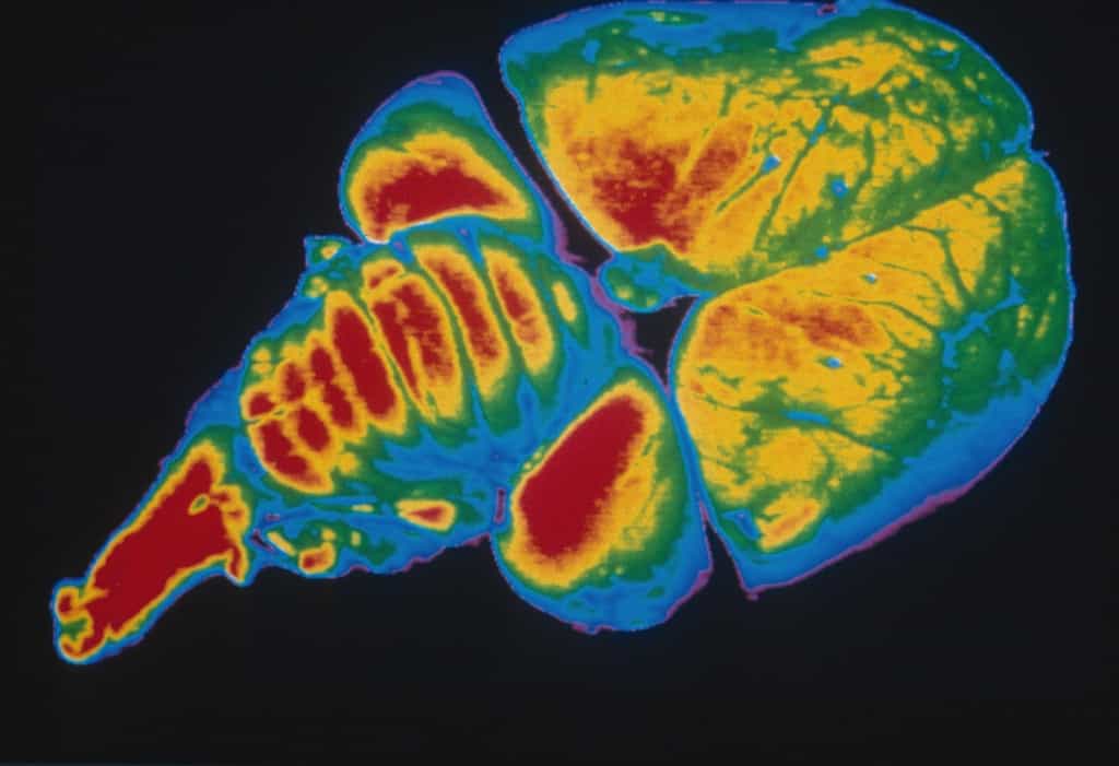 Image numérisée d'un cerveau de poussin, en fausses couleurs