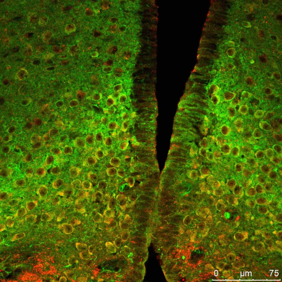 Neurones de l'hypothalamus, au cœur du cerveau