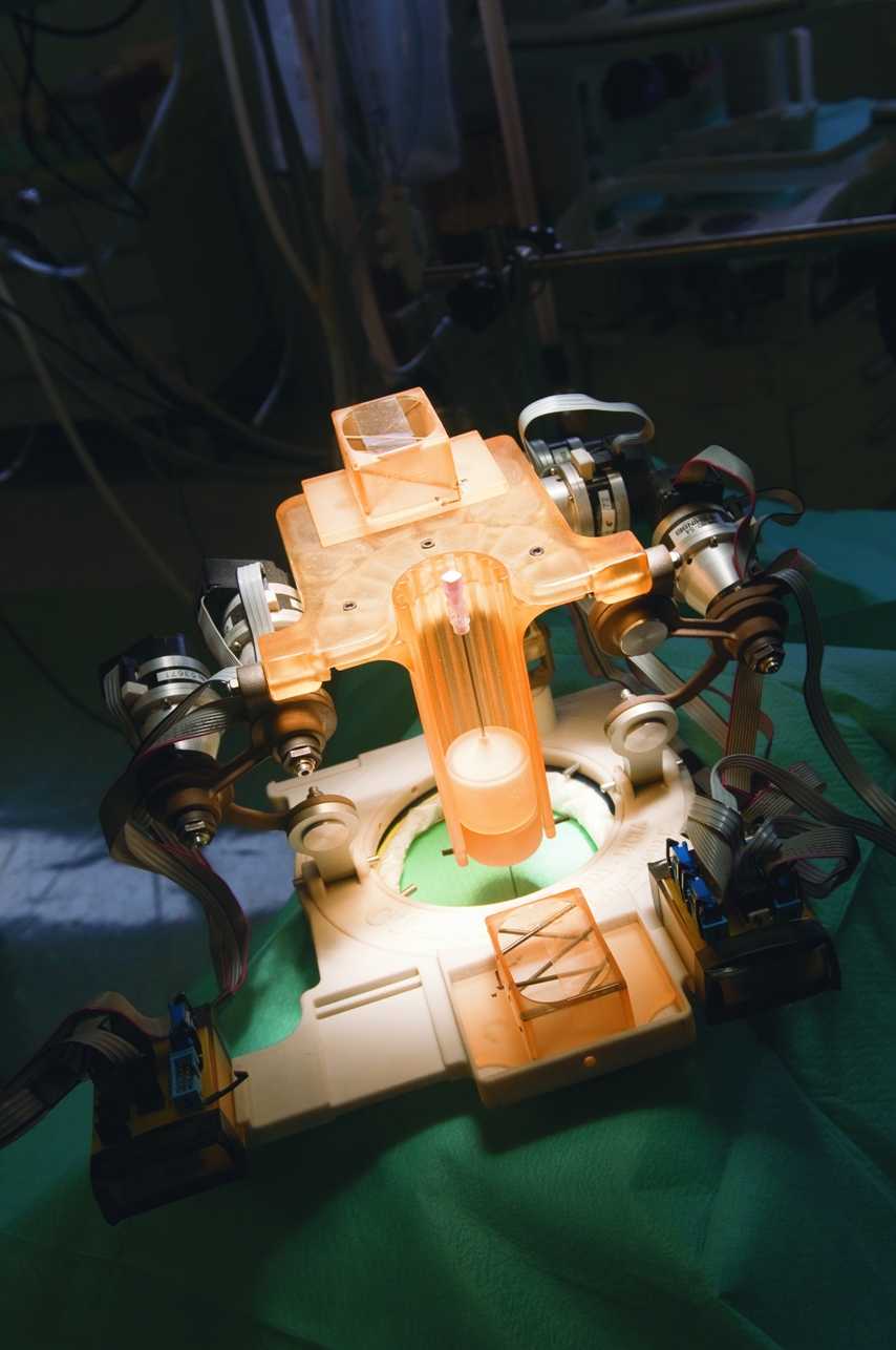 Les robots guidés par scanner, l'avenir de la chirurgie ?