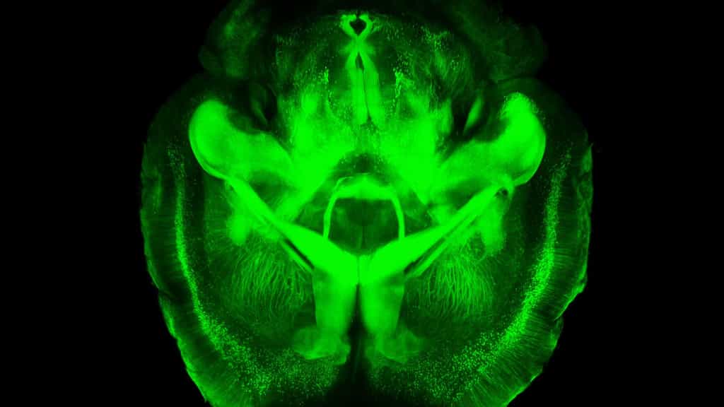 Un cerveau de souris transparent. Des chercheurs de l'université Stanford, aux États-Unis, ont rendu transparent le cerveau d'une souris grâce à la technologie Clarity. Ils l'ont ensuite imprégné d'anticorps fluorescents se fixant sélectivement sur les neurones. On peut ainsi visualiser le réseau neuronal en 3D sans avoir recours à la dissection. © Stanford School of Medicine