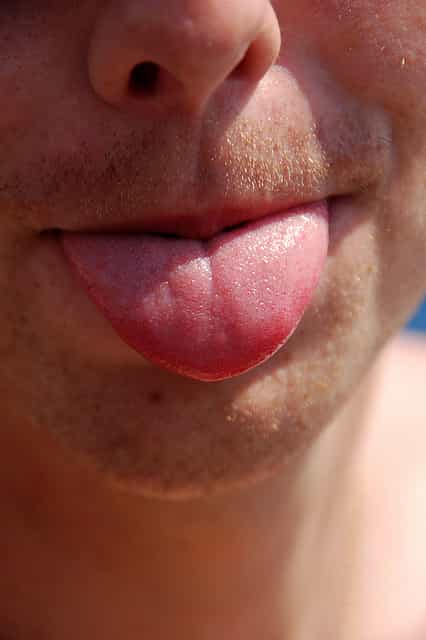La langue est un organe essentiel qui sert à la mastication, à la phonation et à la déglutition. Un paraglosse correspond à son gonflement. © Sylvain Bourdos, Flickr, cc by nc sa 2.0