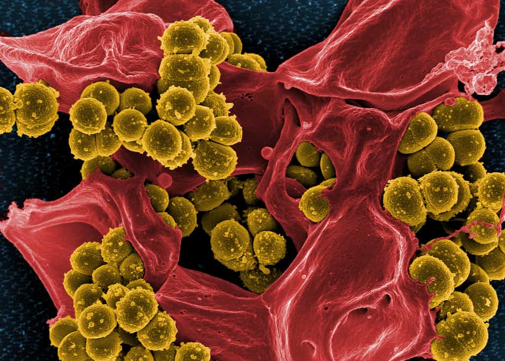 Le staphylocoque doré est de plus en plus résistant aux antibiotiques. On peut en apercevoir ici quelques représentants (en jaune), accompagnés d’un neutrophile mort (en rouge). Comprendre comment cette bactérie infecte les cellules est indispensable pour mettre en place des traitements alternatifs aux antibiotiques. © NIAID, Flickr, cc by 2.0